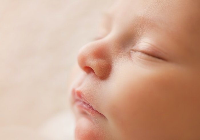 赤ちゃんの肌荒れの原因は？原因や対策、受診の目安を解説