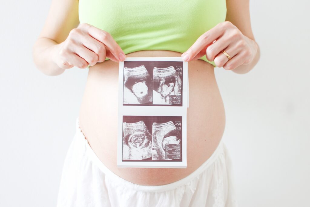 妊娠初期に出血 妊娠初期におこる出血の原因と対処法を解説 妊娠 出産 Hanako ママ Web