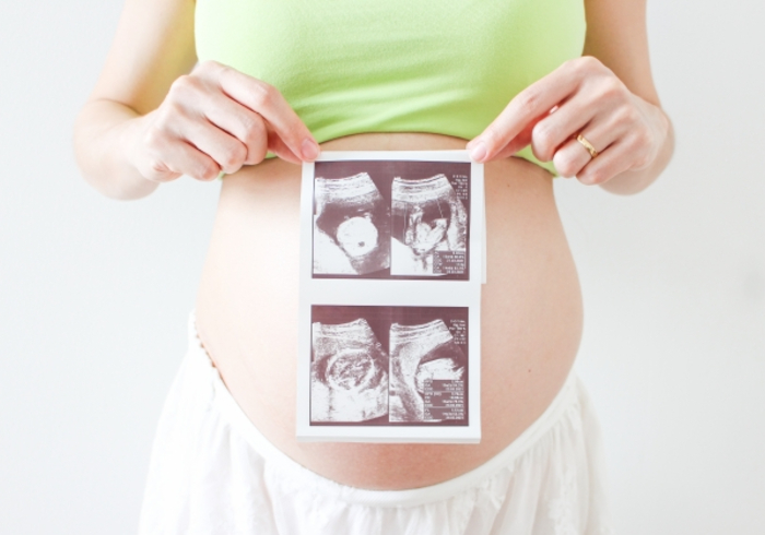 妊婦健診で双子とわかるのはいつ 健診内容や通院頻度などを解説 妊娠 出産 Hanako ママ Web
